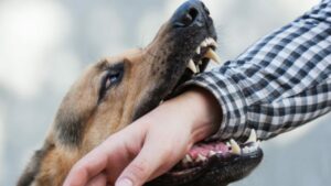 Who is liable for dog bites in California?
